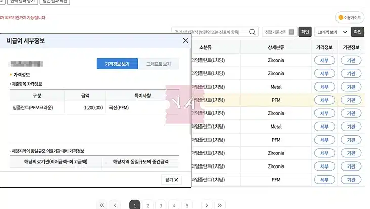 임플란트 가격 비교 방법, 병원별 시세 쉽게 확인하는 꿀팁