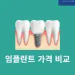 임플란트 가격 비교 방법, 병원별 시세 쉽게 확인하는 꿀팁