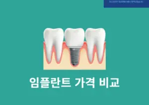 임플란트 가격 비교 방법, 병원별 시세 쉽게 확인하는 꿀팁